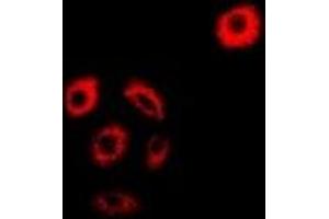 Immunofluorescent analysis of AMPK beta 2 staining in MCF7 cells. (PRKAB2 antibody)