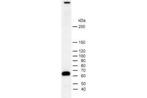 dilution: 1 : 2000, sample: rat brain homogenate (Piccolo antibody  (AA 4439-4776))