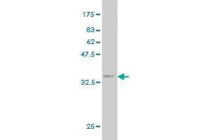 Western Blot detection against Immunogen (32. (PMM2 antibody  (AA 47-111))
