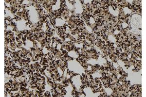 ABIN6272551 at 1/100 staining Rat lung tissue by IHC-P. (PPP1R9B antibody  (C-Term))