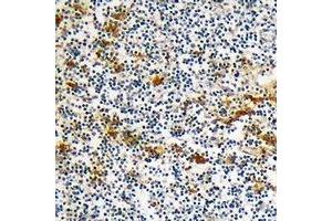 Immunohistochemical analysis of DOK6 staining in human lymph node formalin fixed paraffin embedded tissue section. (DOK6 antibody)