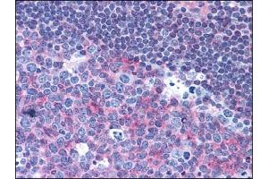 Immunohistochemistry (IHC) image for anti-CD40 (CD40) antibody (ABIN400699)
