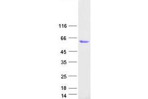 Western Blotting (WB) image for Glycoprotein A33 (Transmembrane) (GPA33) protein (Myc-DYKDDDDK Tag) (ABIN2713901)