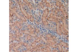 Figure. (IL-13 antibody  (AA 22-131))