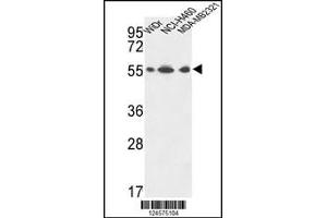 Western blot analysis in WiDr,NCI-H460,MDA-MB231 cell line lysates (35ug/lane). (ATP5A1 antibody  (C-Term))