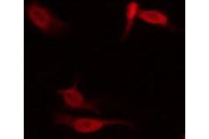 Immunofluorescence (fixed cells) (IF/ICC) image for anti-Signal Transducer and Activator of Transcription 1, 91kDa (STAT1) (pSer727) antibody (ABIN6256410)