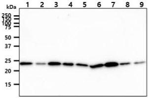 The cell lysates (40ug) were resolved by SDS-PAGE, transferred to PVDF membrane and probed with anti-human CINP antibody (1:1000). (CINP antibody)