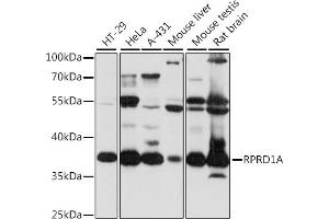 Western blot analysis of extracts of various cell lines, using RPRD1A antibody (ABIN7269895) at 1:1000 dilution. (RPRD1A antibody  (AA 47-276))