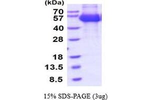 SDS-PAGE (SDS) image for Interferon alpha/beta Receptor 1 (IFNAR1) (AA 27-429) protein (His tag) (ABIN7281163) (IFNAR1 Protein (AA 27-429) (His tag))