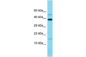 Western Blotting (WB) image for anti-Mitochondrial Ribosomal Protein L14 (MRPL14) (C-Term) antibody (ABIN2791154) (MRPL14 antibody  (C-Term))