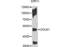 Western blot analysis of extracts of 22RV1 cells, using GOLM1 antibody. (GOLM1 antibody)