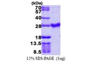 RAB4A, Member RAS Oncogene Family (RAB4A) (AA 1-218) protein (His tag)