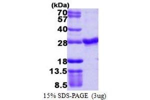SDS-PAGE (SDS) image for RAB4A, Member RAS Oncogene Family (RAB4A) (AA 1-218) protein (His tag) (ABIN667483)