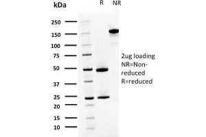 SDS-PAGE Analysis Purified S100A4 Mouse Monoclonal Antibody (CPTC-S100A4-3). (s100a4 antibody)