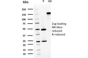 SDS-PAGE Analysis Purified S100A4 Mouse Monoclonal Antibody (CPTC-S100A4-3). (s100a4 antibody)