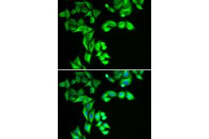 Immunofluorescence analysis of HeLa cells using STRN3 antibody. (STRN3 antibody)