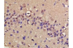 Formalin-fixed and paraffin embedded rat brain labeled with Rabbit Anti-ERCC8/CSA Polyclonal Antibody, Unconjugated (ABIN1713778) at 1:200 followed by conjugation to the secondary antibody and DAB staining (ERCC8 antibody  (AA 161-260))