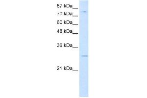 WB Suggested Anti-RBM28 Antibody Titration:  0.