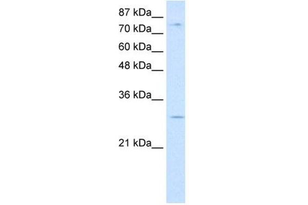 RBM28 抗体  (C-Term)