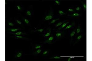 Immunofluorescence of purified MaxPab antibody to ZCCHC9 on HeLa cell. (ZCCHC9 antibody  (AA 1-271))
