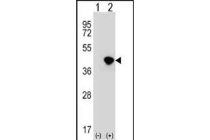Western Blotting (WB) image for anti-DNA Fragmentation Factor, 45kDa, alpha Polypeptide (DFFA) (AA 304-331), (C-Term) antibody (ABIN653234)