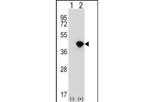 Western blot analysis of DFFA (arrow) using rabbit polyclonal DFFA Antibody (C-term) (ABIN653234 and ABIN2842766). (DFFA antibody  (C-Term))