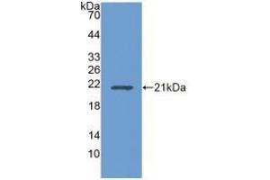UBE2L3 anticorps  (AA 4-154)