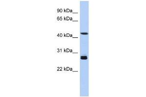 SYT9 antibody used at 1 ug/ml to detect target protein. (SYT9 antibody  (Middle Region))