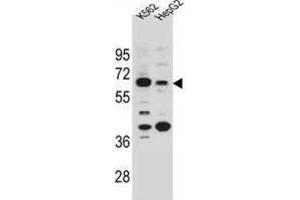 Western Blotting (WB) image for anti-Na+/H+ Exchanger Domain Containing 1 (NHEDC1) antibody (ABIN2996071)