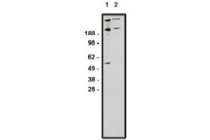 Image no. 1 for anti-Zinc Finger Protein GLI1 (GLI1) antibody (ABIN4620372) (GLI1 antibody)