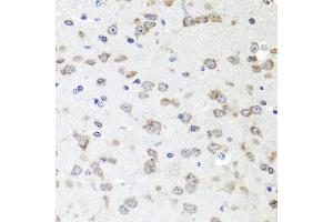 Immunohistochemistry of paraffin-embedded mouse brain using IGFBP5 antibody (ABIN6130485, ABIN6142257, ABIN6142259 and ABIN6216084) at dilution of 1:100 (40x lens). (IGFBP5 antibody  (AA 68-167))