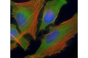 Immunofluorescent staining of permeabilized human HeLa cells with ASS1 antibody at 1:25 dilution, followed by Dylight 488-conjugated goat anti-rabbit lgG (green).