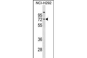 COL9A3 Antibody (Center) (ABIN1881221 and ABIN2838976) western blot analysis in NCI- cell line lysates (35 μg/lane).