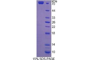 Image no. 1 for Rac GTPase Activating Protein 1 (RACGAP1) (AA 106-539) protein (His tag,GST tag) (ABIN6237046) (RACGAP1 Protein (AA 106-539) (His tag,GST tag))