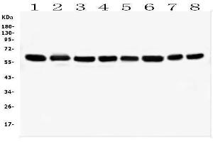 Western blot analysis of HSPD1 using anti-HSPD1 antibody (ABIN7600976). (HSPD1 antibody  (AA 260-496))