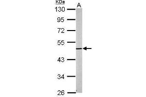 WB Image Sample (20 ug of whole cell lysate) A: mouse brain 10% SDS PAGE antibody diluted at 1:5000 (Cnpase antibody)