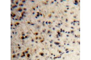 Used in DAB staining on fromalin fixed paraffin-embedded Brain tissue (KISS1 antibody  (AA 1-126))