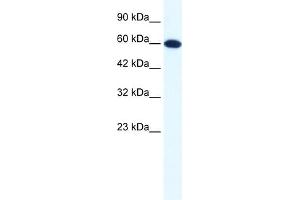 WB Suggested Anti-DDX6 Antibody Titration:  1. (DDX6 antibody  (N-Term))