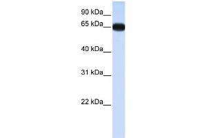 WB Suggested Anti-DLX4 Antibody Titration:  0. (DLX4 antibody  (N-Term))