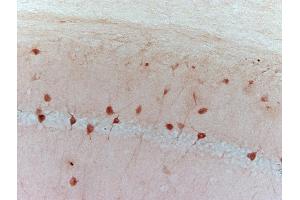 Formalin-fixed frozen sections of mouse hippocampus labeled with Anti-EF1 Alpha Polyclonal Antibody, Unconjugated (ABIN741210) followed by conjugation to the secondary antibody (eEF1A1 antibody  (AA 131-230))