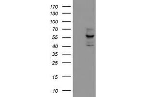 HEK293T cells were transfected with the pCMV6-ENTRY control (Left lane) or pCMV6-ENTRY CYP17A1 (Right lane) cDNA for 48 hrs and lysed. (CYP17A1 antibody)