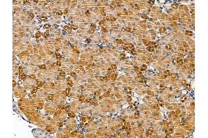 anti-Purinergic Receptor P2X, Ligand Gated Ion Channel 2 (P2RX2) (C-Term) antibody