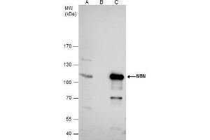 IP Image NBS1 antibody immunoprecipitates nibrin protein in IP experiments.