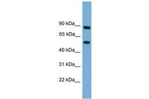 Image no. 1 for anti-Raftlin Family Member 2 (RFTN2) (N-Term) antibody (ABIN6744995)