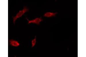 ABIN6276160 staining HeLa by IF/ICC. (OR4X1 antibody  (C-Term))