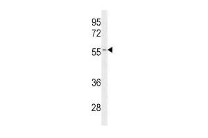 Western blot analysis of CYP2C19 Antibody (Center) (ABIN390665 and ABIN2840960) in Jurkat cell line lysates (35 μg/lane). (CYP2C19 antibody  (AA 257-285))