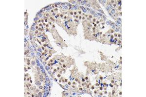 Immunohistochemistry of paraffin-embedded mouse testis using PI3 Kinase p85 beta Rabbit mAb (ABIN1679407, ABIN3019246, ABIN3019247 and ABIN7101736) at dilution of 1:100 (40x lens). (PIK3R2 antibody)