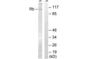 Western Blotting (WB) image for anti-Retinoblastoma 1 (RB1) (Ser608) antibody (ABIN7180079)
