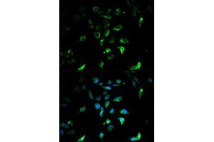 Immunofluorescence analysis of U2OS cells using STAR antibody (ABIN5970406) at dilution of 1/100. (STAR antibody)