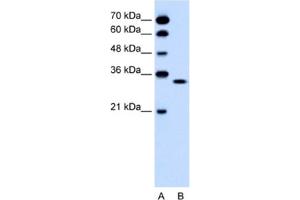 Western Blotting (WB) image for anti-Olfactory Receptor, Family 5, Subfamily T, Member 2 (OR5T2) antibody (ABIN2462482) (OR5T2 antibody)